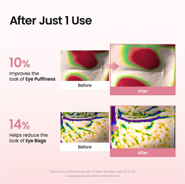 Radiant Eye Revive Patches